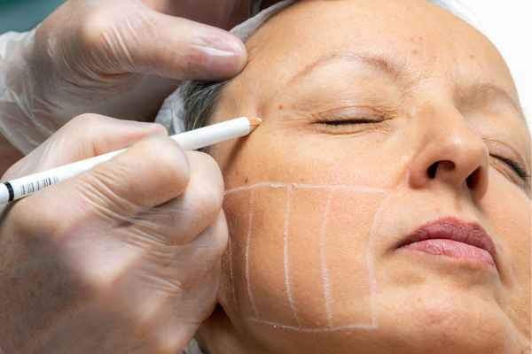 CryoPen: 5 Skin Concerns It May Be Used to Treat 4 What should you ask before having CryoPen treatment Bournemouth?