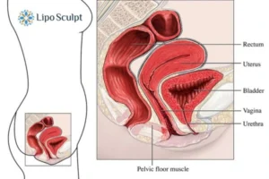 Treatment For A Leaky Bladder 2 How EM Chair treatment Bournemouth can help Leaky bladder issues. Read more now!