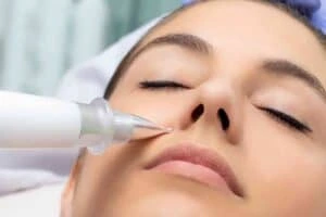 Best Actinic Keratoses Removal 3 Actinic keratoses Bournemouth solutions - book in today!
